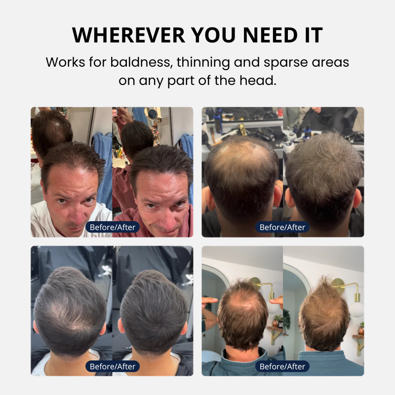 Hair Density Cream