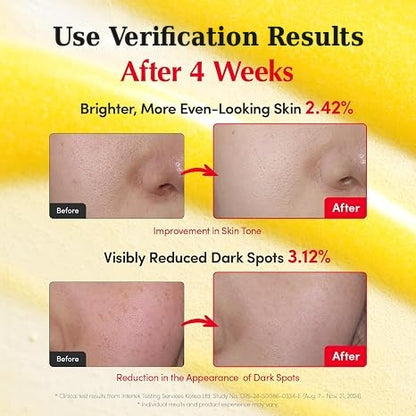 Vitamin Illuminating Serum | Fade the look of dark spots. Turn on your glow.